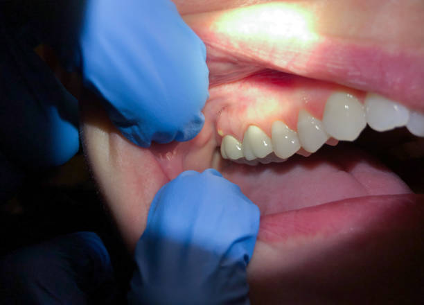 Best Emergency Treatment for Toothache in Sewaren, NJ