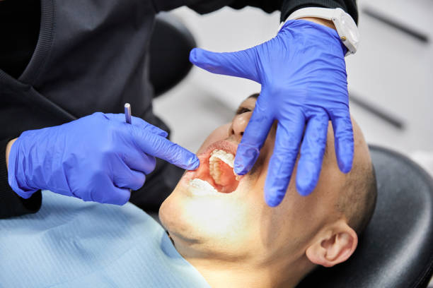 Best Emergency Wisdom Teeth Removal in Sewaren, NJ